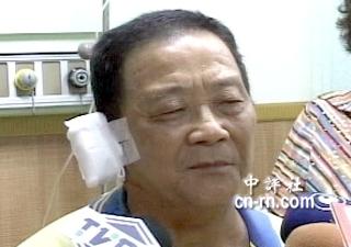 砆民秈囊膟某z縞鳦{端Y憟鉆q跌截瓜