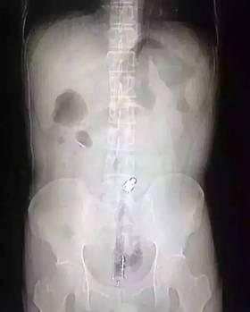 ���d����o20���������J �K�e�|��c�q