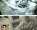嬰兒出生瞬間 握住醫生指頭