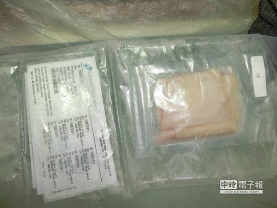 臺"衛福部":大體皮膚夠用 以塵爆患者需求優先(圖) 臺"衛福部":大體皮膚夠用 以塵爆患者需求優先(圖)