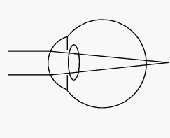 qsMagic Leap45
